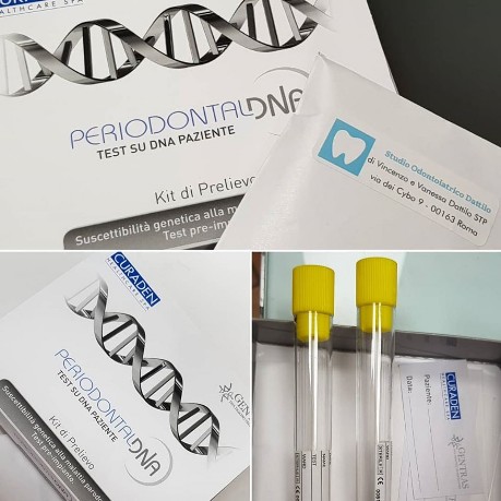 Periodontal DNA test DNA su paziente