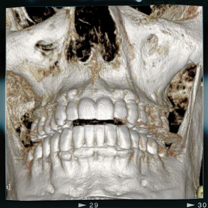 radiologia digitale